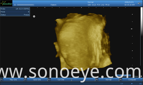 image for labtop ultrasound